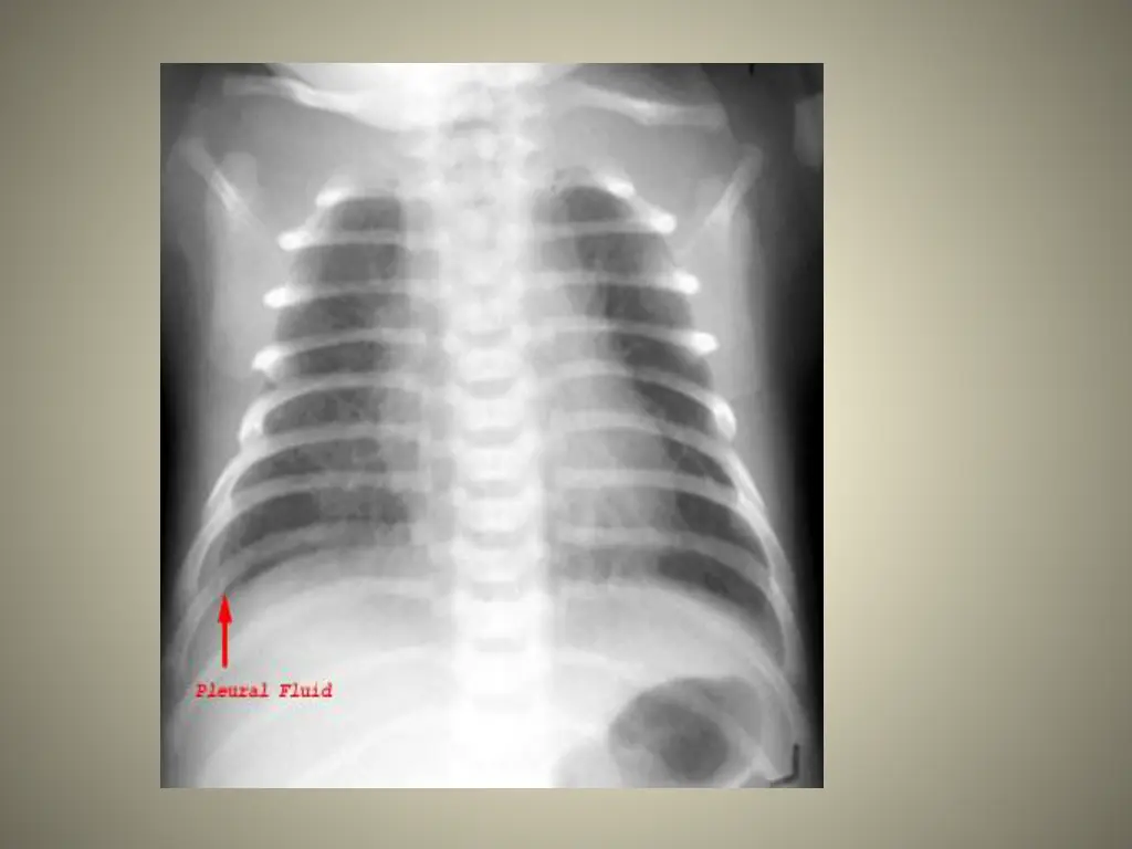 slide15