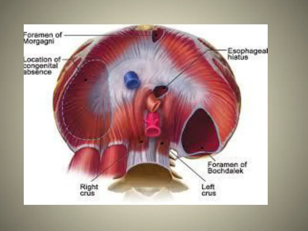 slide20