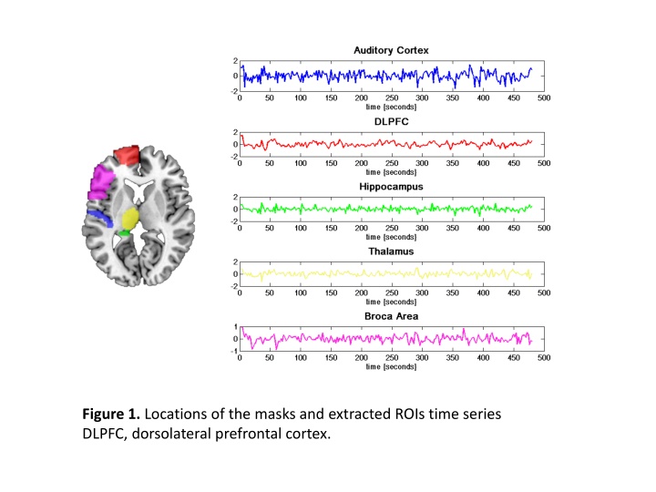 figure 1 locations of the masks and extracted