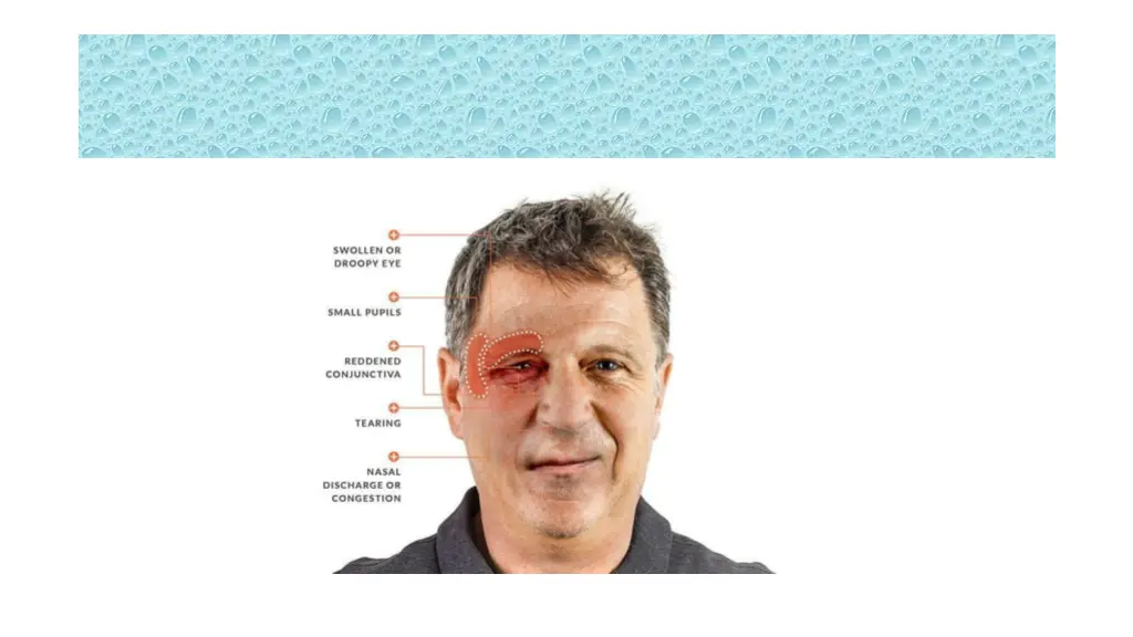 slide29