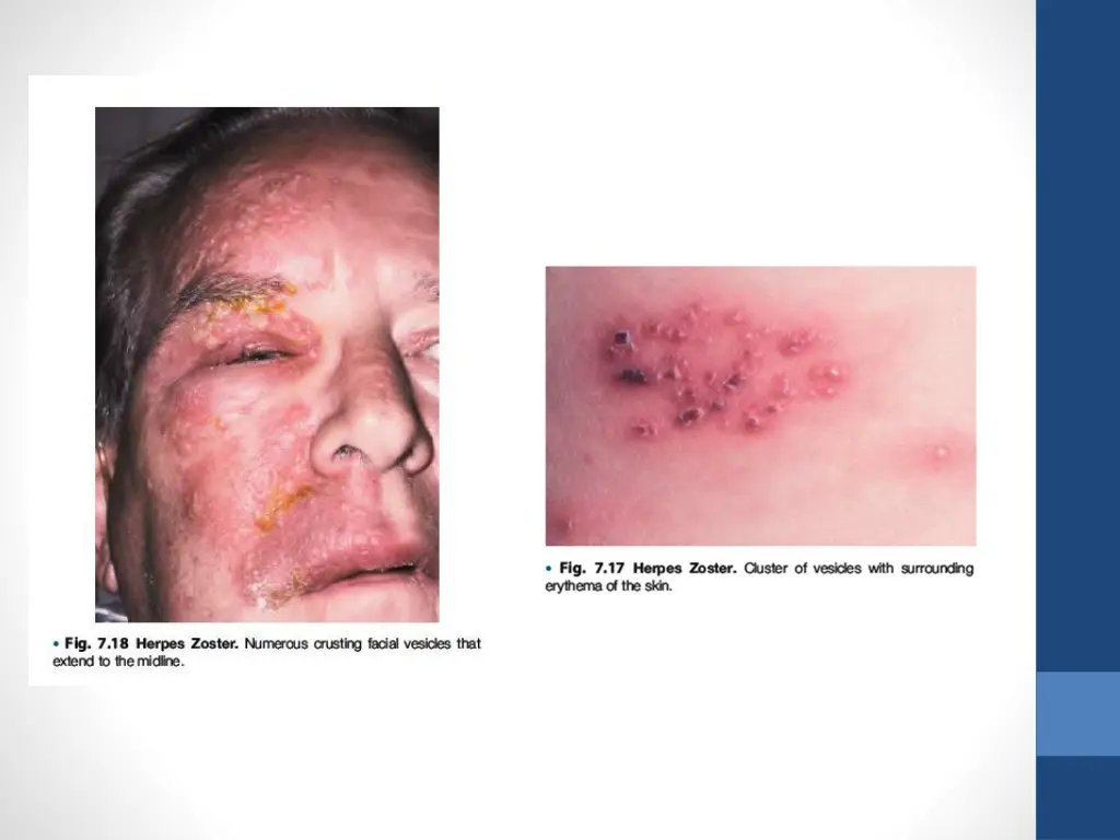 slide11