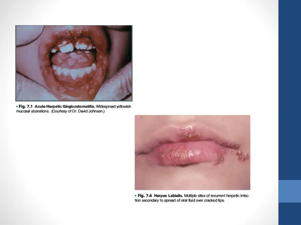slide5