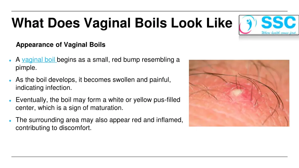 what does vaginal boils look like