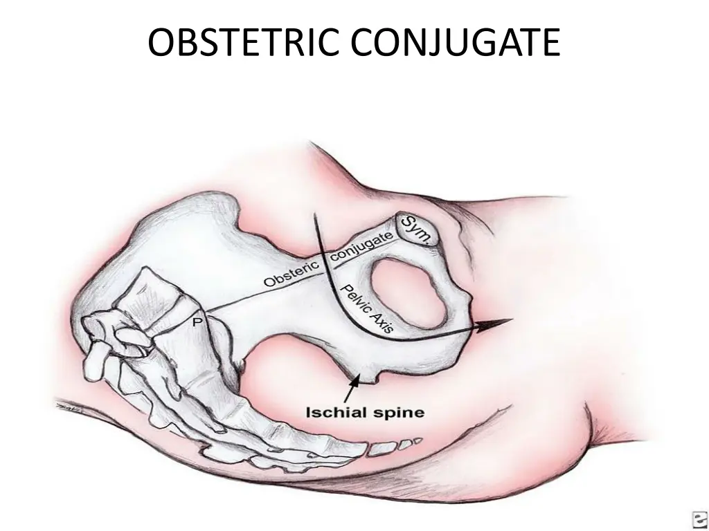 obstetric conjugate