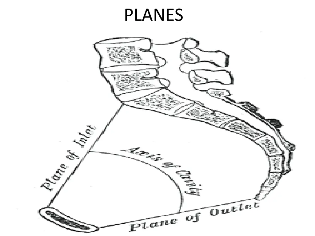 planes