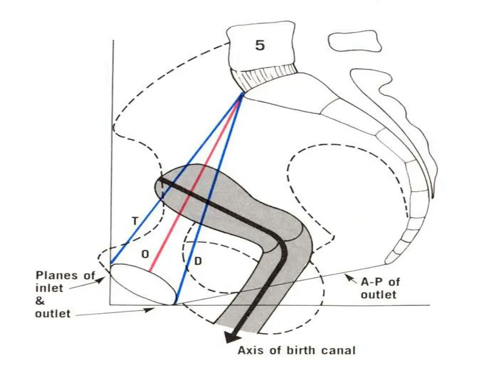 slide13