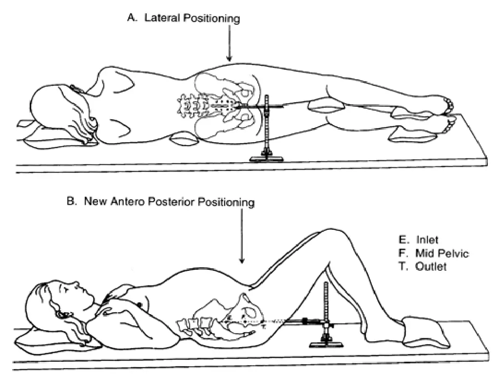 slide20