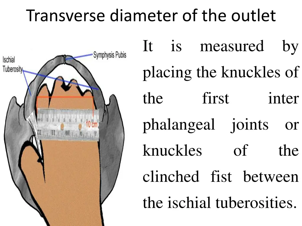 transverse diameter of the outlet