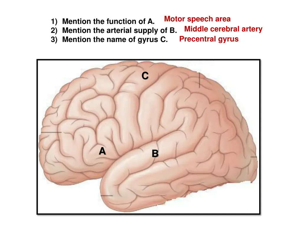 motor speech area middle cerebral artery