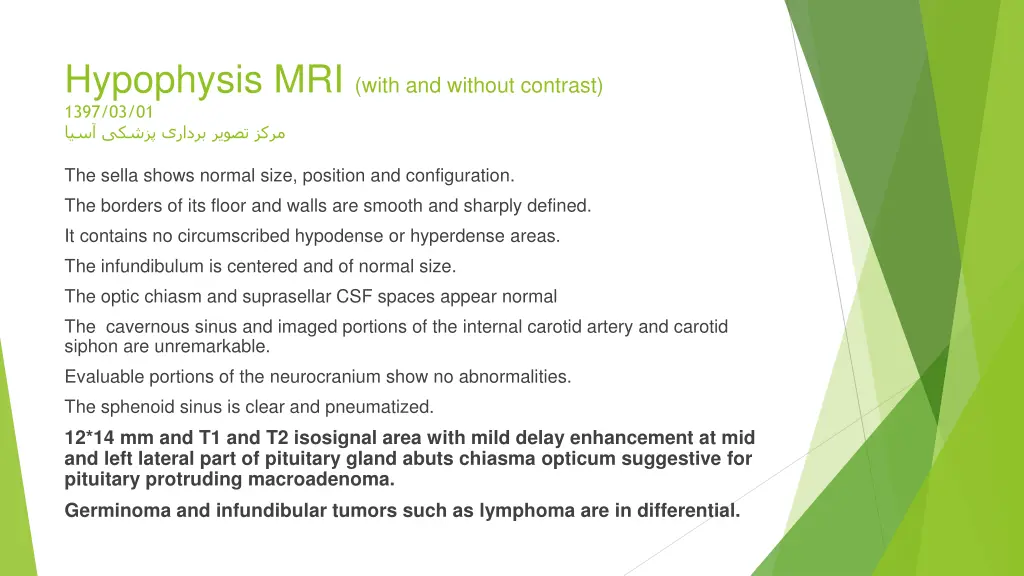 hypophysis mri with and without contrast 1397