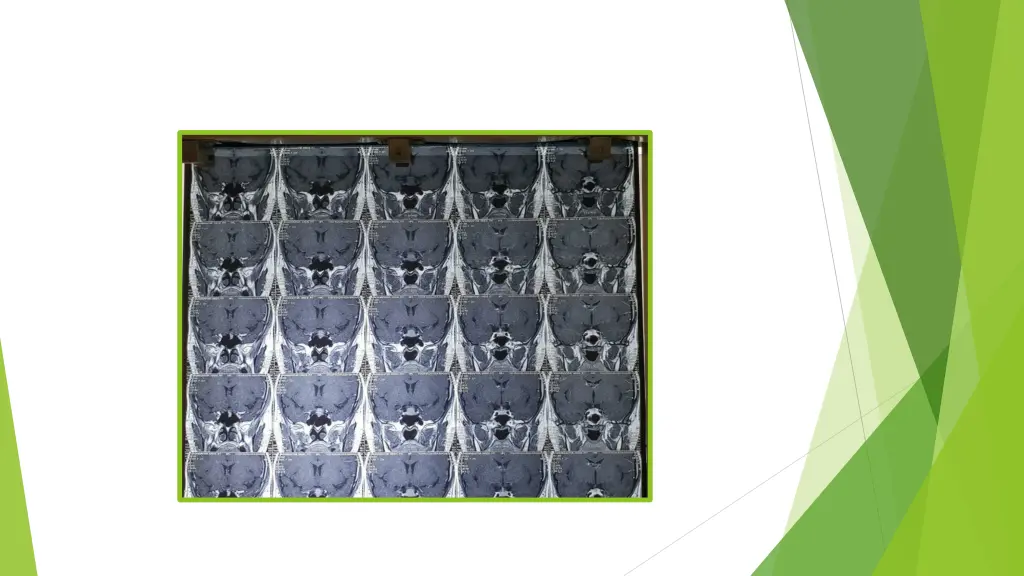 slide11