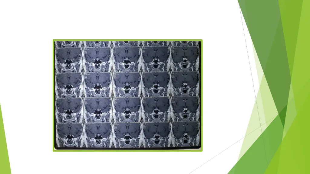 slide12
