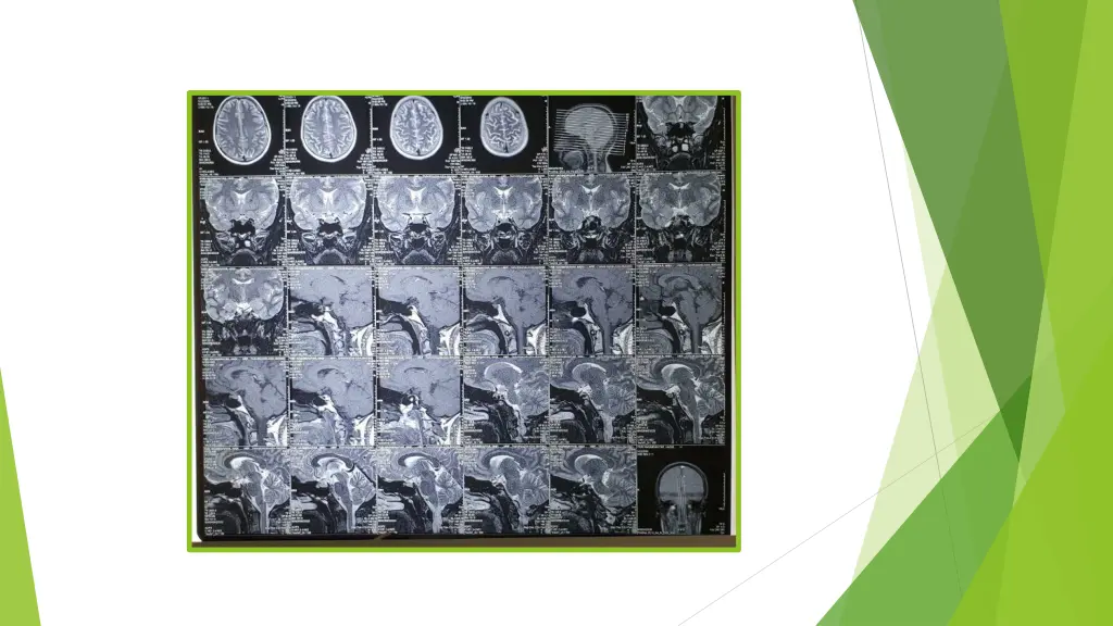 slide19
