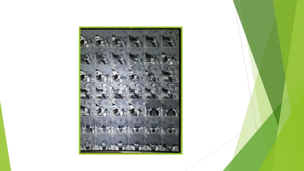 slide9