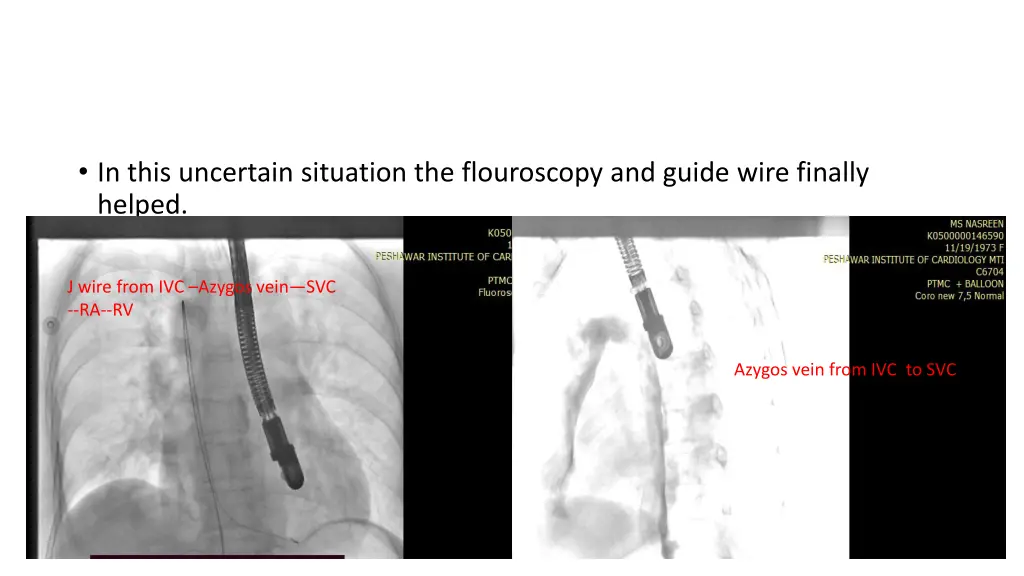 in this uncertain situation the flouroscopy