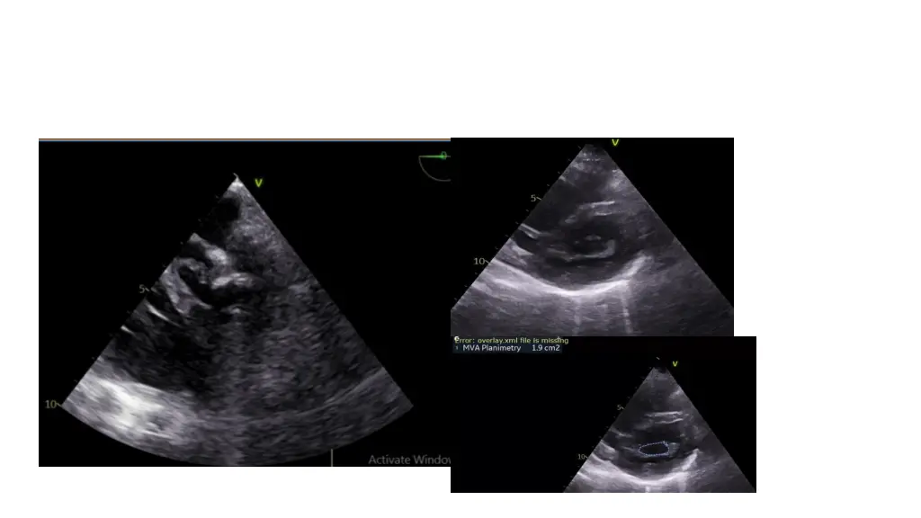 slide11