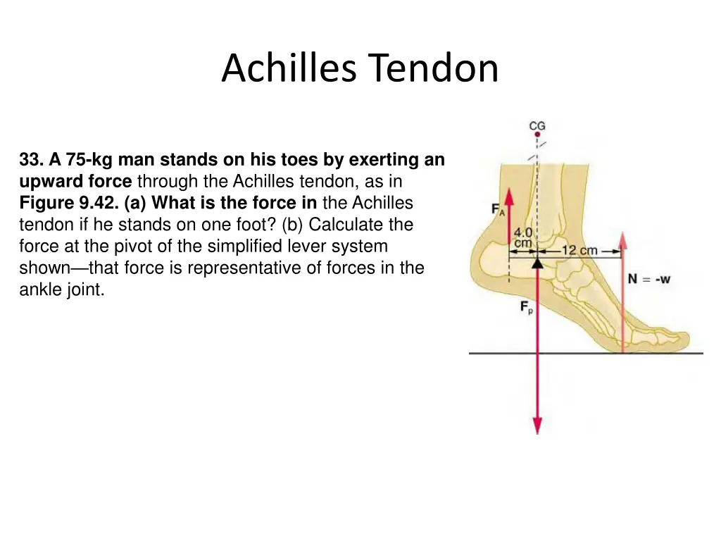 achilles tendon