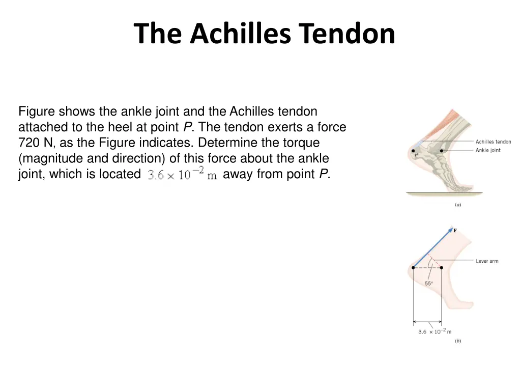 the achilles tendon