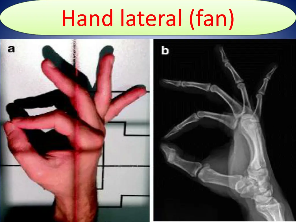 hand lateral fan