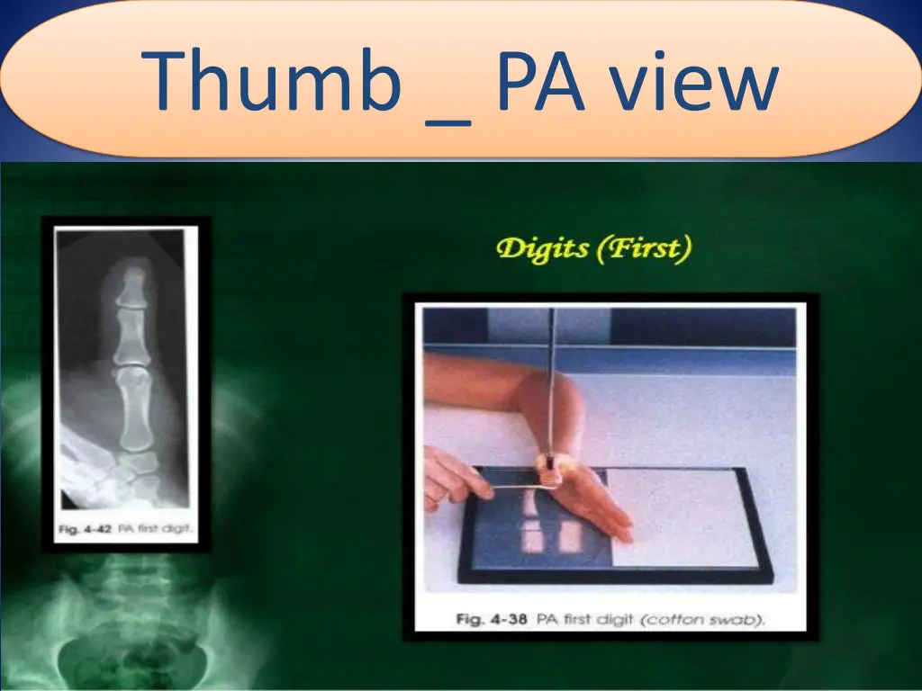 thumb pa view