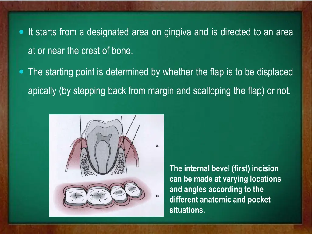 it starts from a designated area on gingiva