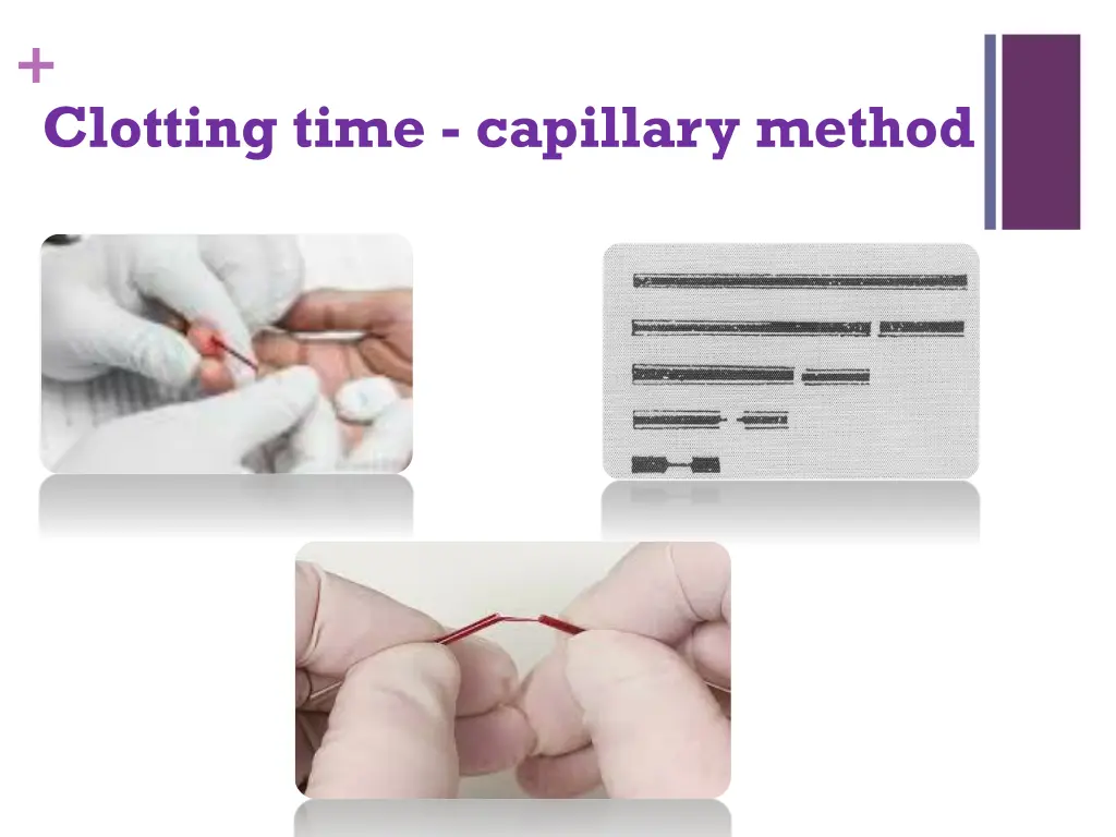 slide7