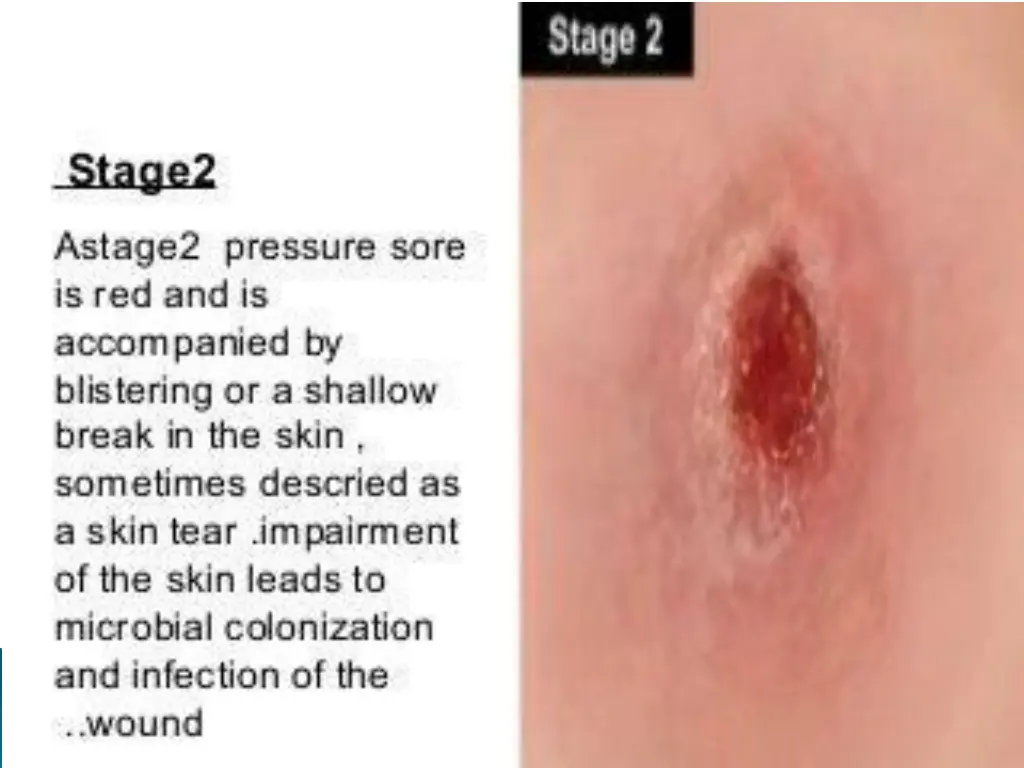 slide19