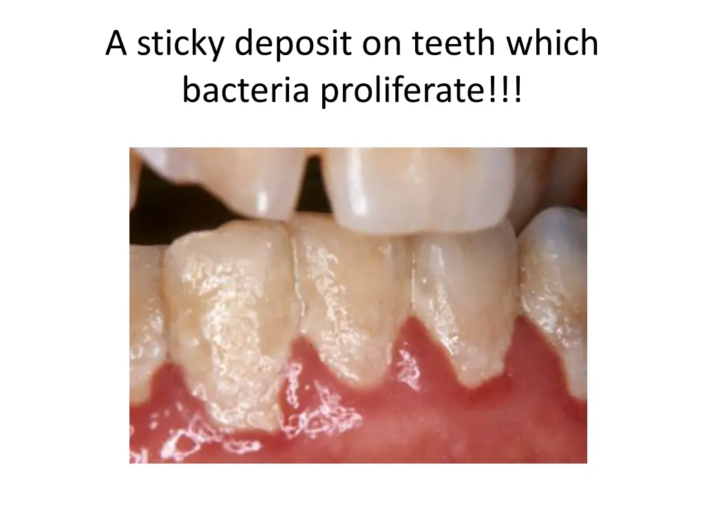 a sticky deposit on teeth which bacteria 1
