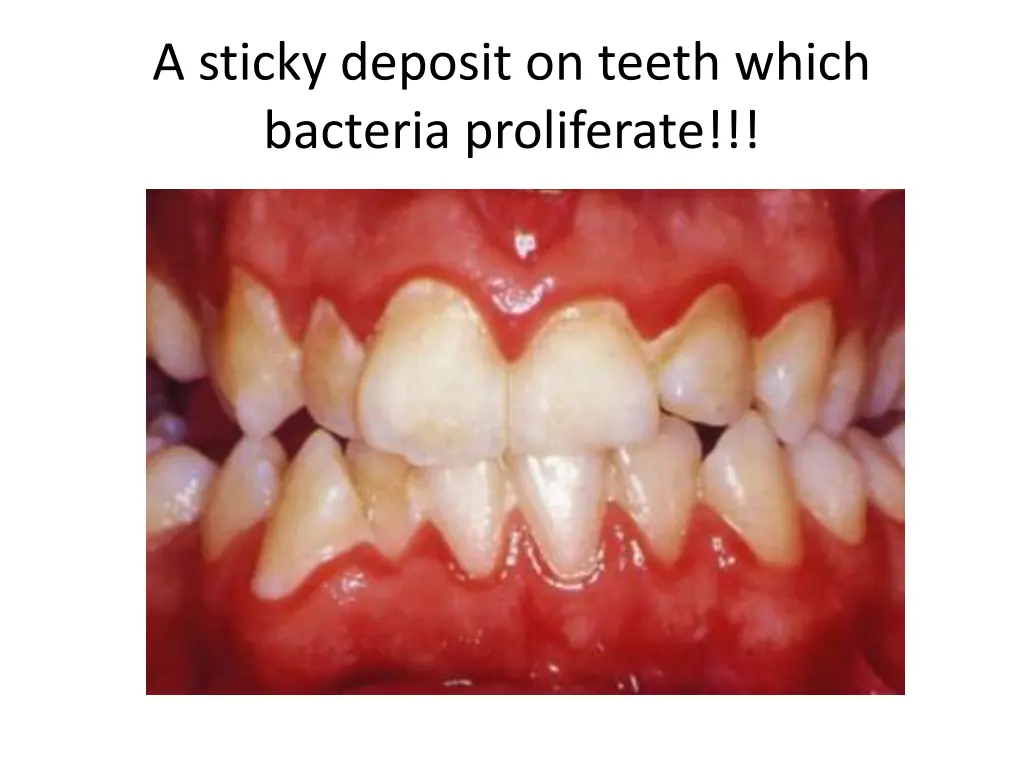 a sticky deposit on teeth which bacteria
