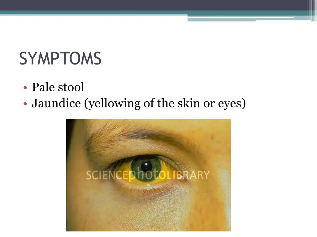 symptoms