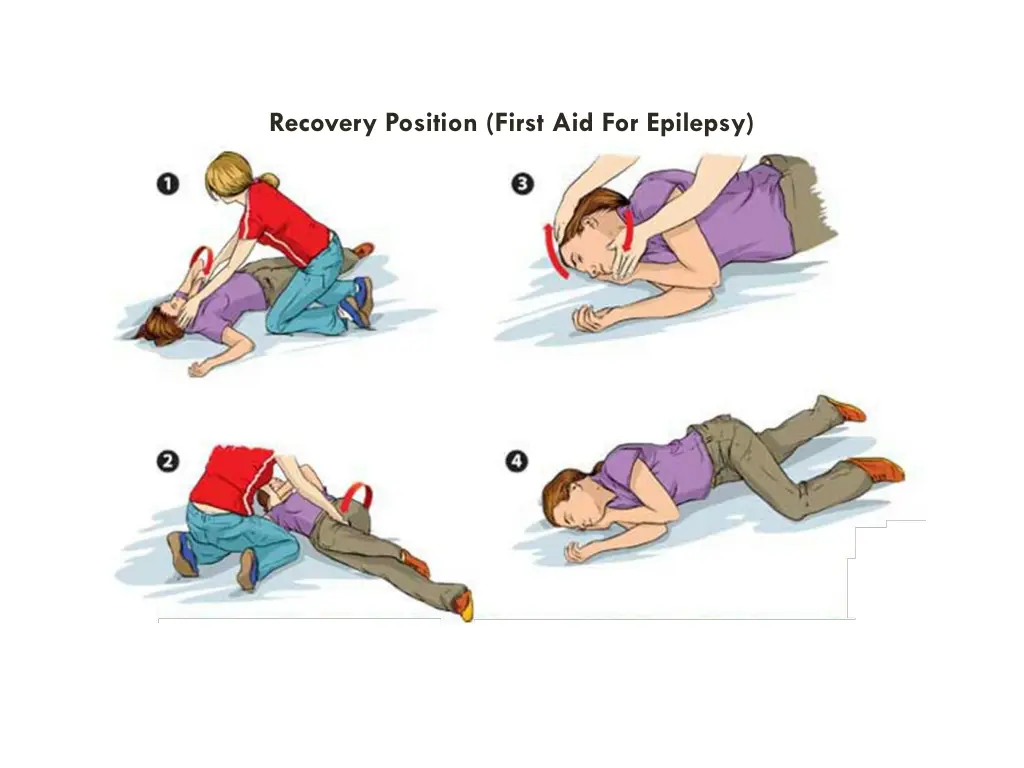 recovery position first aid for epilepsy