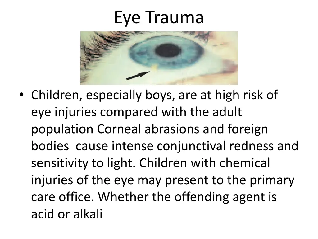 eye trauma
