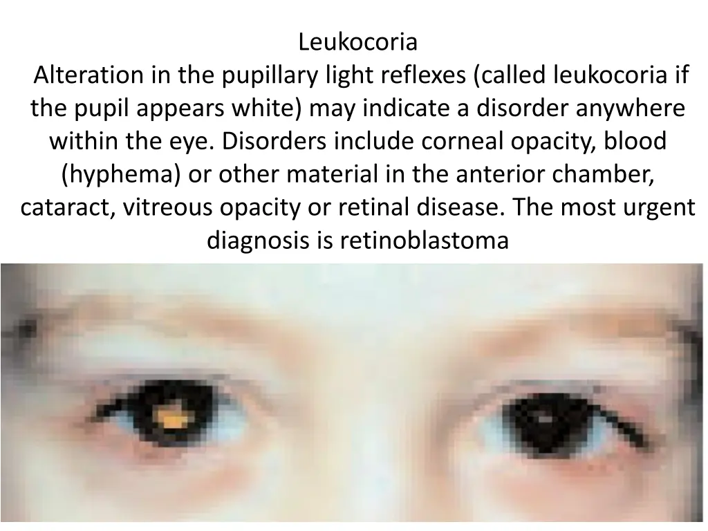 leukocoria
