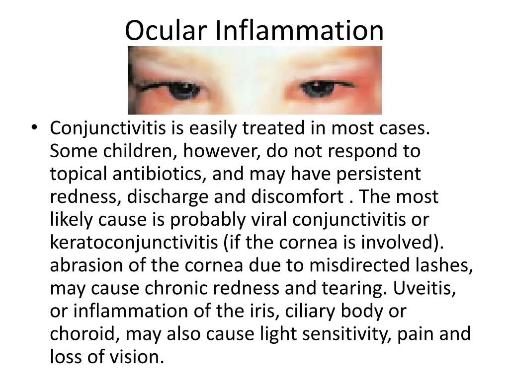 ocular inflammation