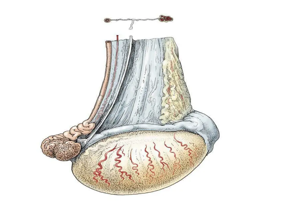 slide5