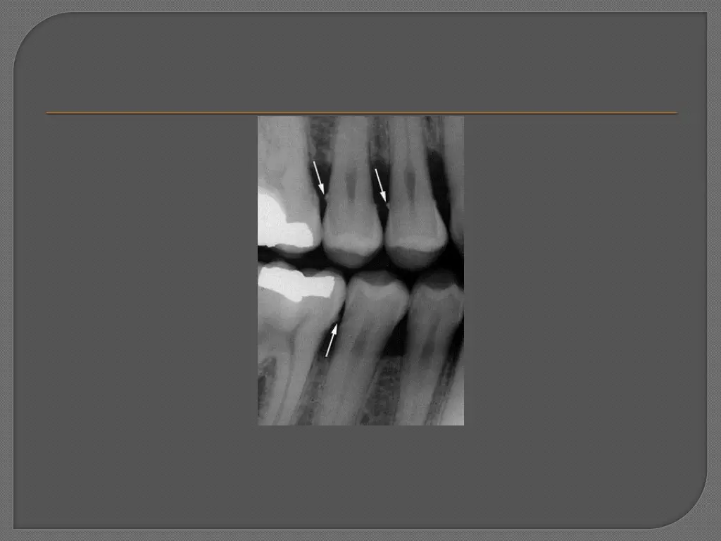 slide15