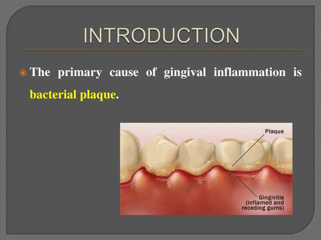 the primary cause of gingival inflammation is