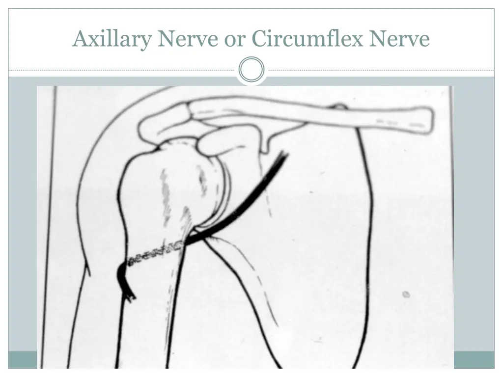 axillary nerve or circumflex nerve