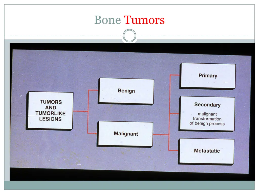 bone tumors