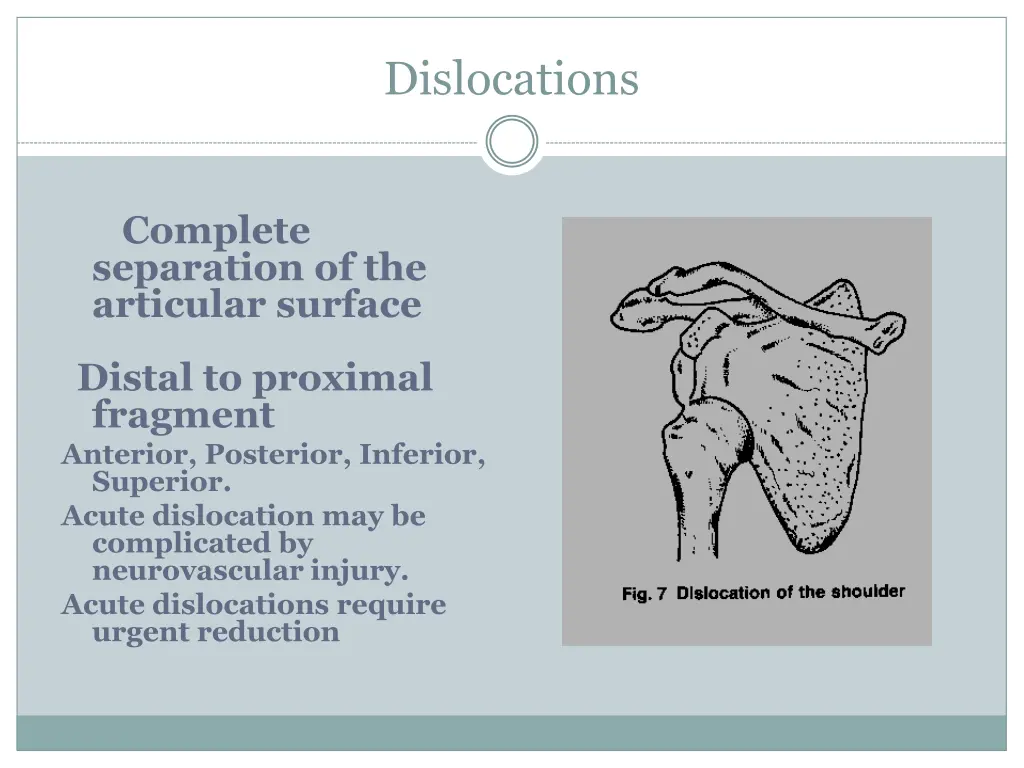 dislocations
