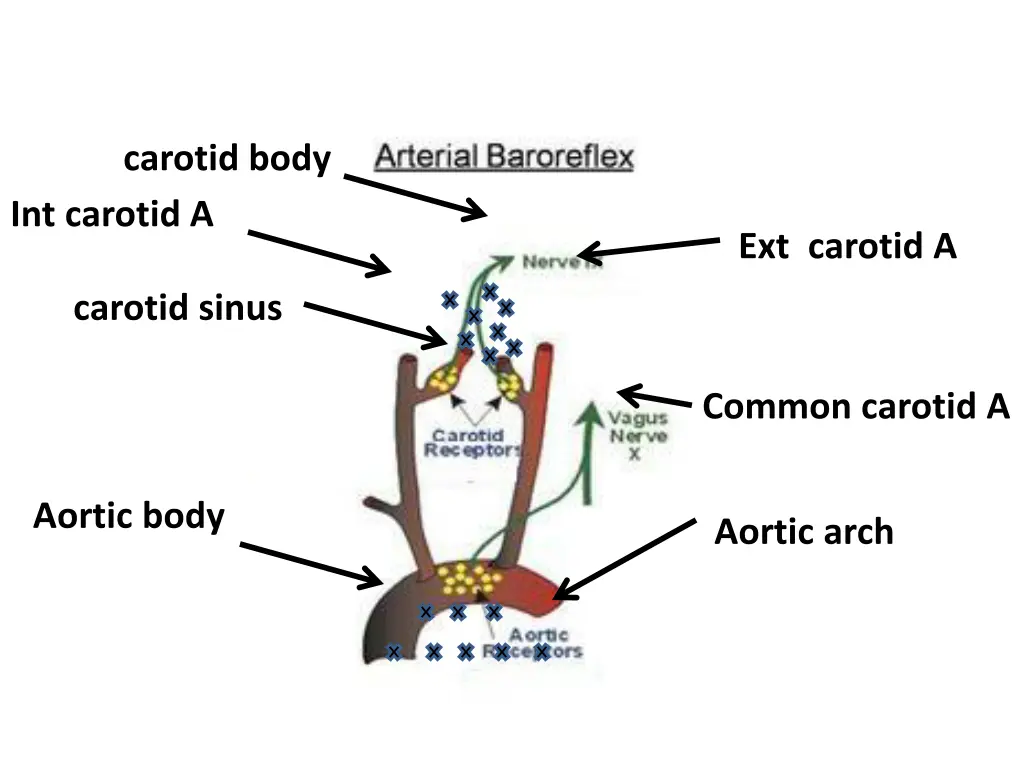 carotid body