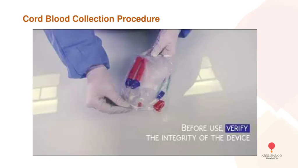 cord blood collection procedure