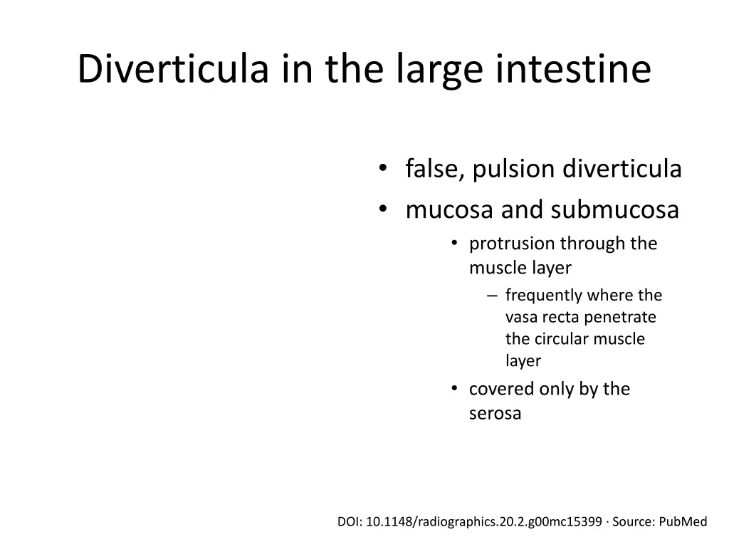 diverticula in the large intestine