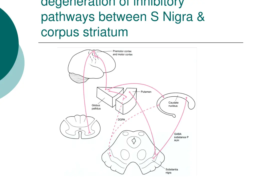degeneration of inhibitory pathways between