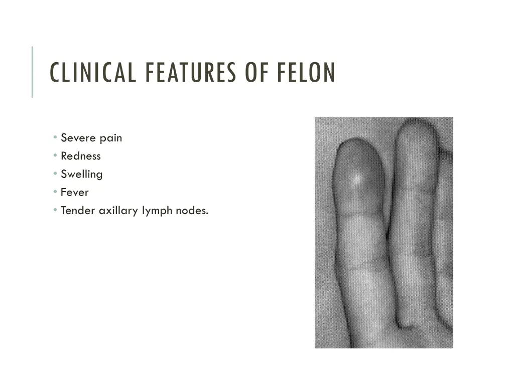 clinical features of felon