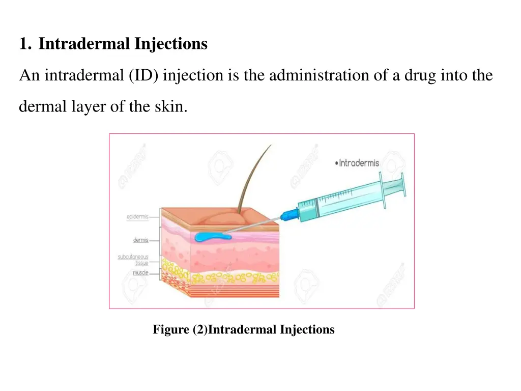 1 intradermal injections