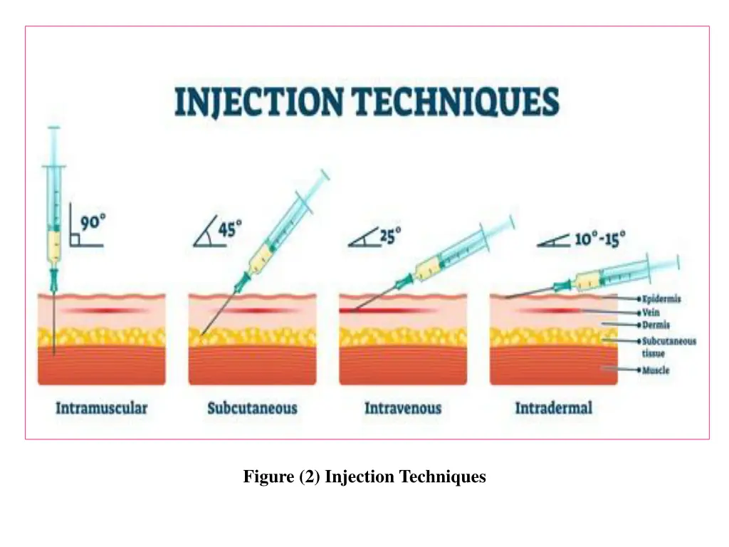 figure 2 injection techniques