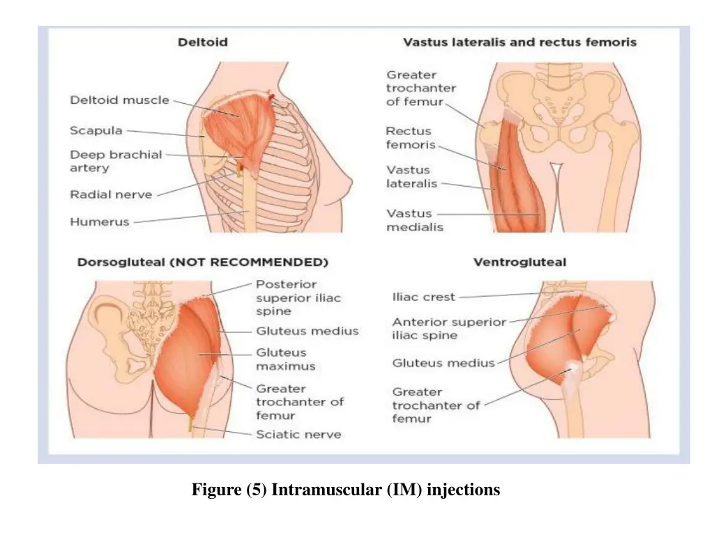 figure 5 intramuscular im injections