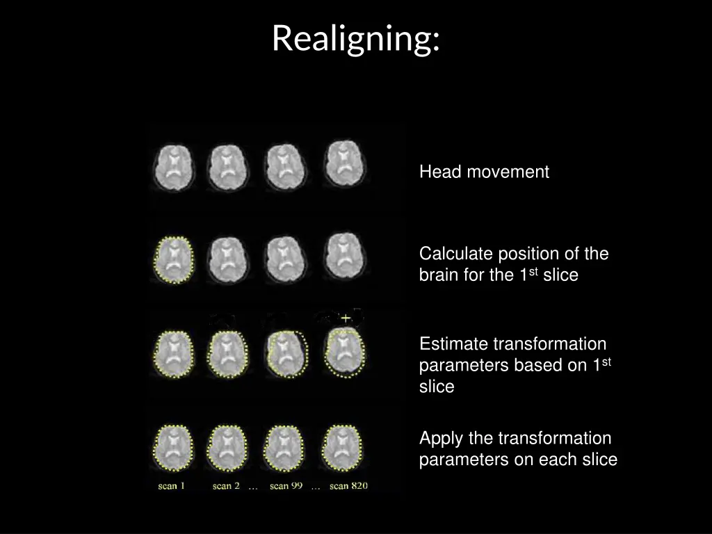 realigning