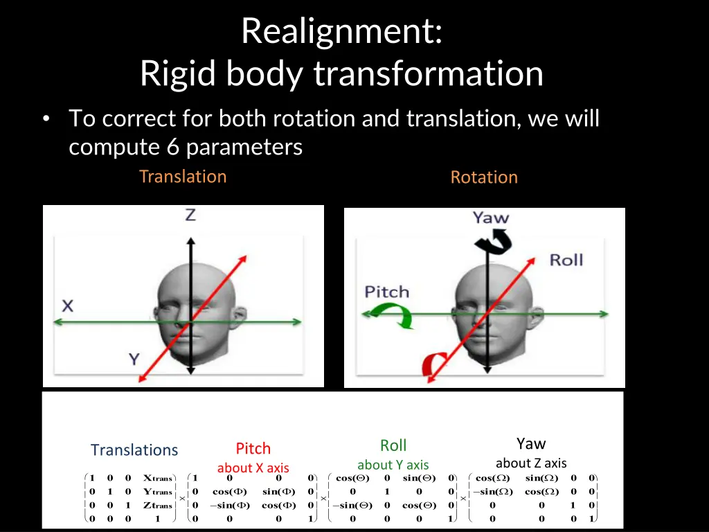 realignment rigid body transformation to correct